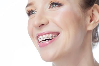 Young woman in braces