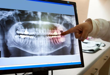 Dental showing digital x ray